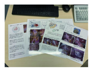 西宮敬愛会病院の鼠径ヘルニア、胆のう手術の手術前説明資料